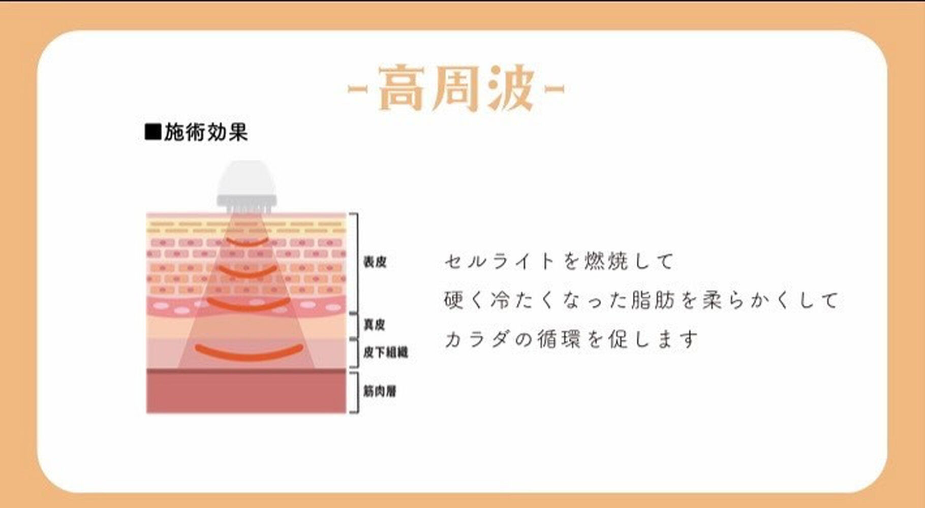 画像1366